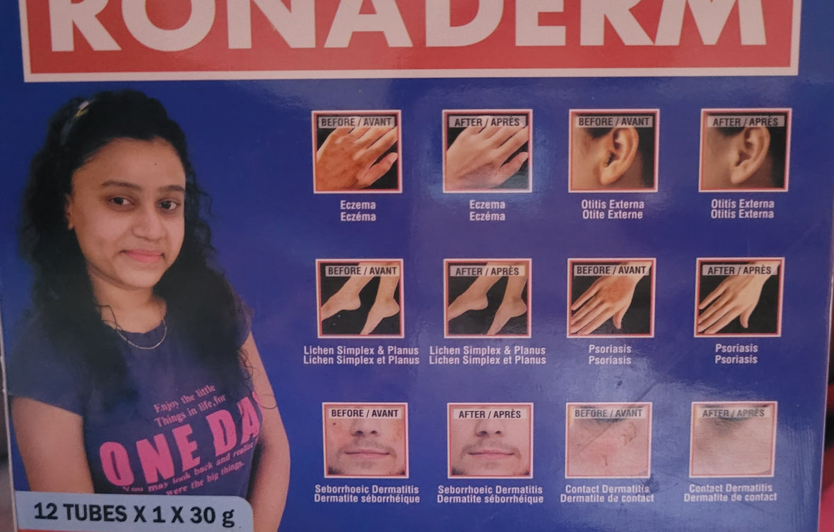 Ronaderm cream – Deli Lakay Boutique LLC